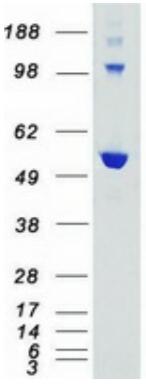 Coomassie blue staining of purified AKT3 protein.